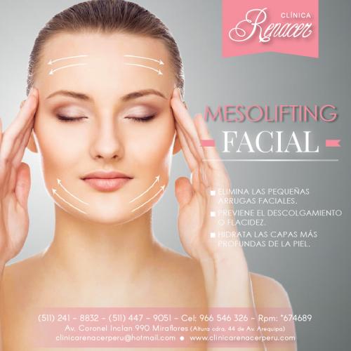 Mesolifting facial  Clínica Renacer Mesolif - Imagen 1