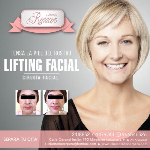Mejora la flacidez de la piel facial  Clíni - Imagen 1