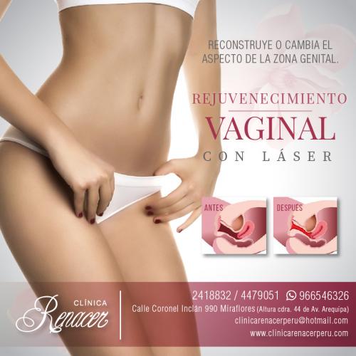 Incrementa la firmeza vaginal  Clínica Rena - Imagen 1