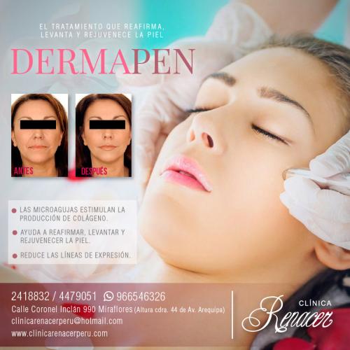 Tratamiento facial Dermapen  Clínica Renace - Imagen 1