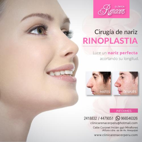 Remodelación de nariz  Clínica Renacer Rin - Imagen 1