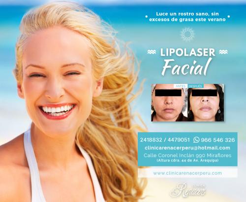 Un mejor rostro con lipolaser  Clínica Rena - Imagen 1