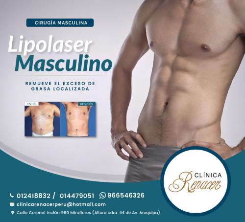 Cirugía Lipolaser en hombres  Clínica Rena - Imagen 1